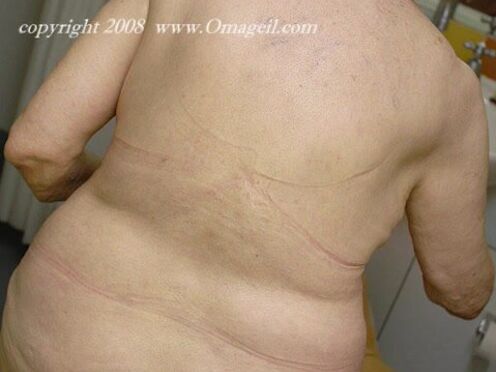 OmaGeiL Nasty Well Aged Ladies Nude & Exposed