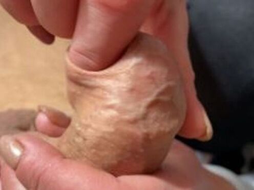 ForeSkin play & CumShot