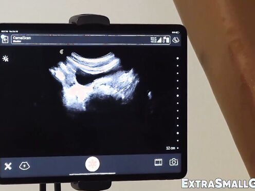 Tiny Tom Bentley have no choice but to watch his butt get drilled by Dr Wolf